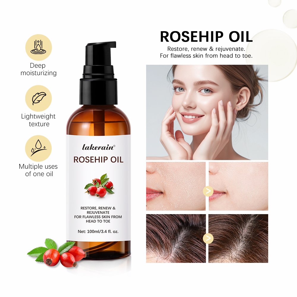 Night Cream - 100ml Multifunction Moisturize Rosehip Essential Oil