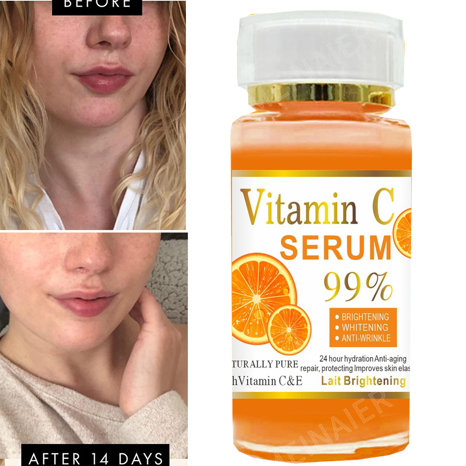 Super 120ml Vitamin C Serum An - Vitamin C Serum recension och pris