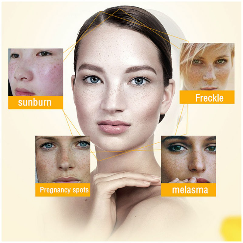 Dimollaure Whitening Freckle C - Night Cream recension och pris