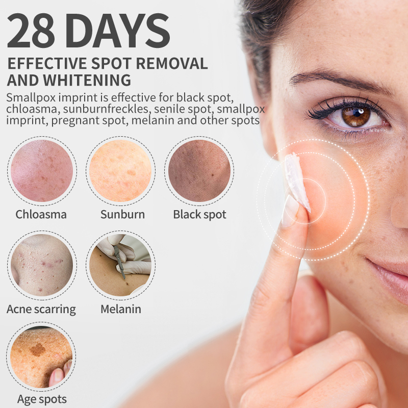 Dimollaure Whitening Freckle C - Night Cream recension och pris