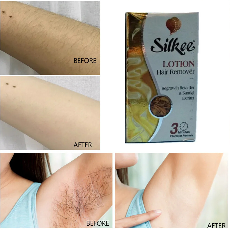 SILKEE CM Hair Removal Lotion  - Body Lotion recension och pris
