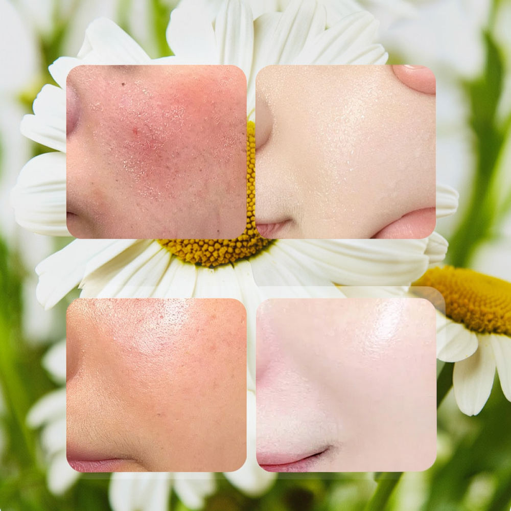 For Fykly Rose VC Chamomile B5 - Face Mask Skincare recension och pris