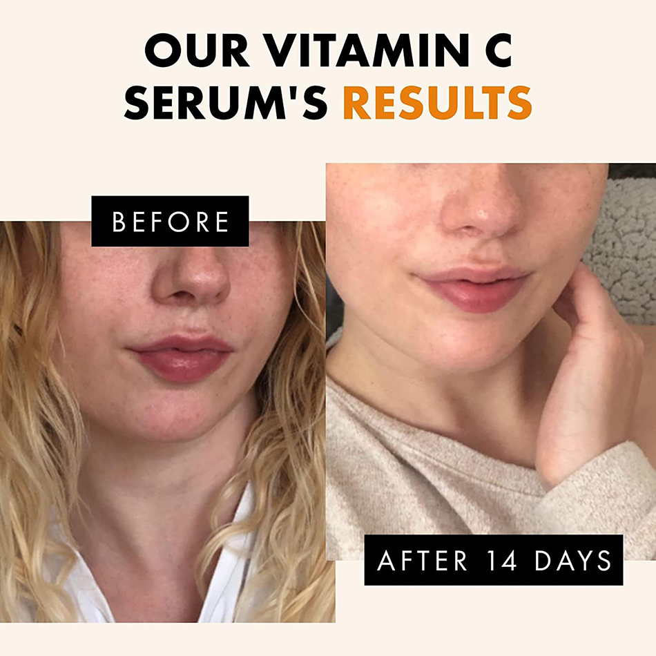 Super 120ml Vitamin C Serum An - Vitamin C Serum recension och pris